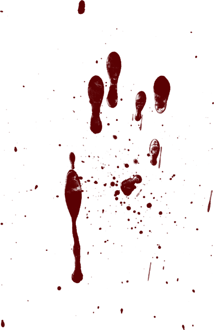 Thumb Image - Kan Lekesi Png (688x1059), Png Download