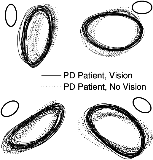 Download An Example Of Drawing The Four Oval Shapes By A Pd - Shape ...