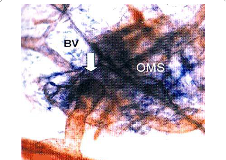 Enzyme Histochemical Staining Of Blood And Lymphatic - Blood Vessel (744x525), Png Download
