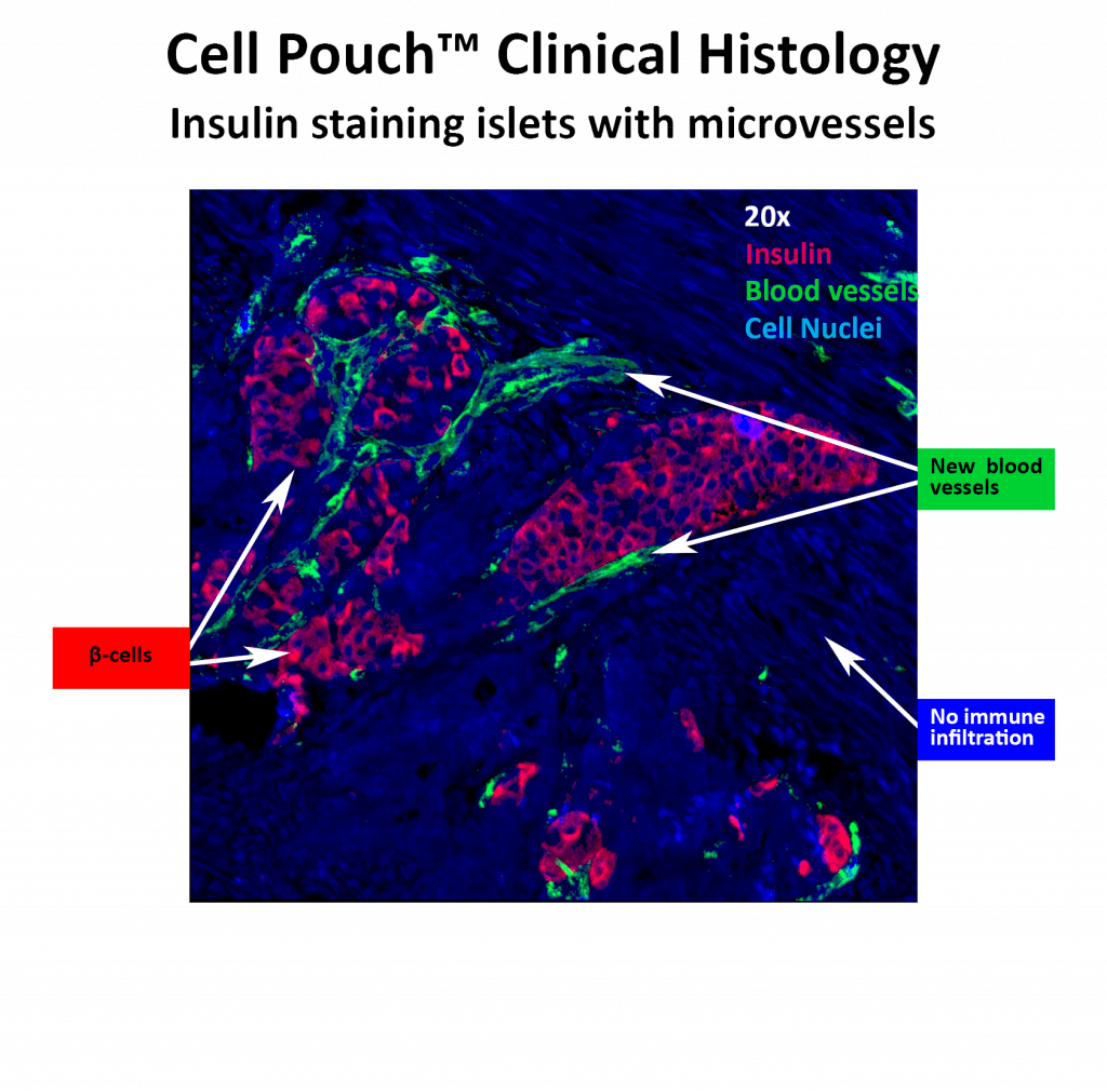 Sernova, A Regenerative Medicine Company Located In - Graphic Design (1024x1011), Png Download