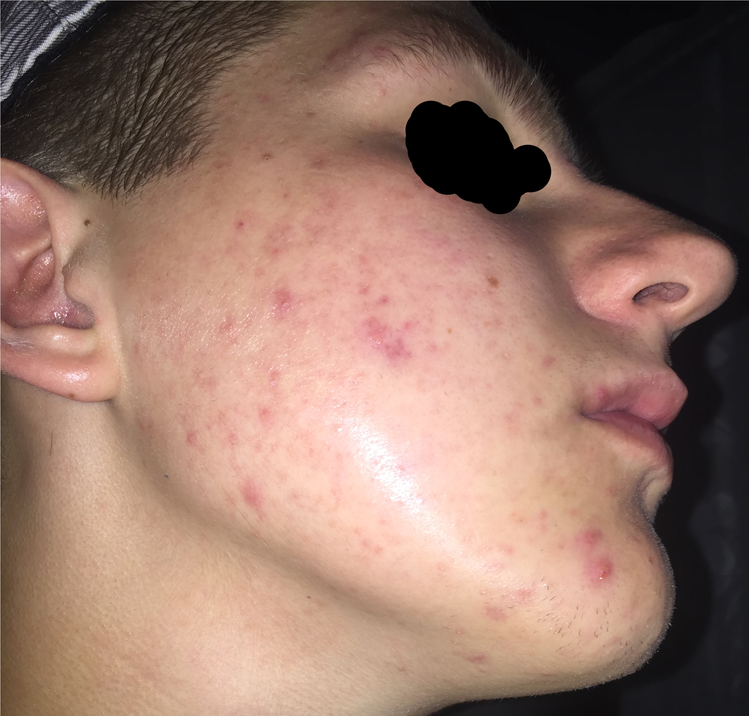 Pic 1 - No Expression (2448x3264), Png Download