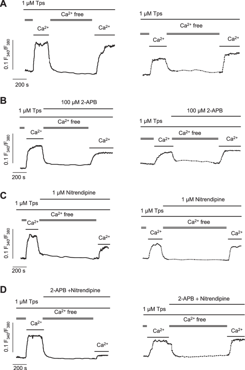 Capacitative Ca 2 Entry Is Impaired In Gallbladder - Diagram (850x1286), Png Download