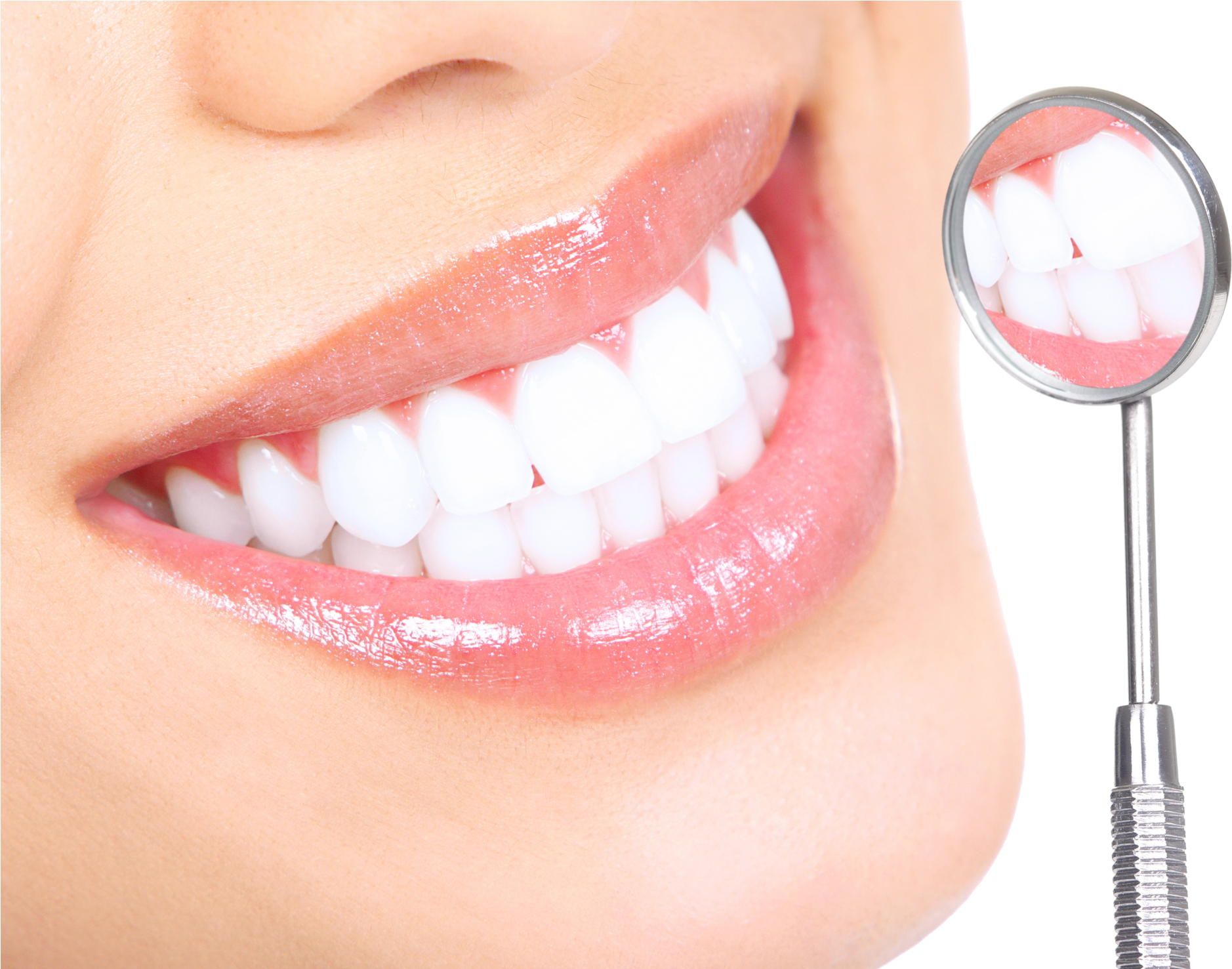 Should I Be Whitening My Teeth - White Teeth Dental Services (2048x1476), Png Download