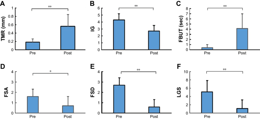 Changes In Ocular Parameters Pre And Post Surgery - Diagram (850x389), Png Download