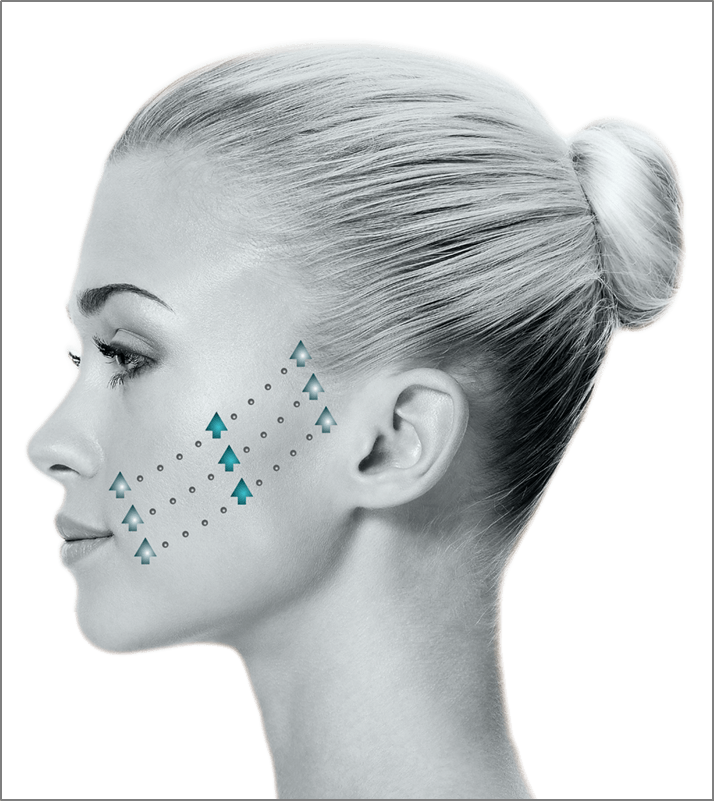 To Learn More About The Benefits Of Instalift, Schedule - Get The Perfect Nose (714x801), Png Download