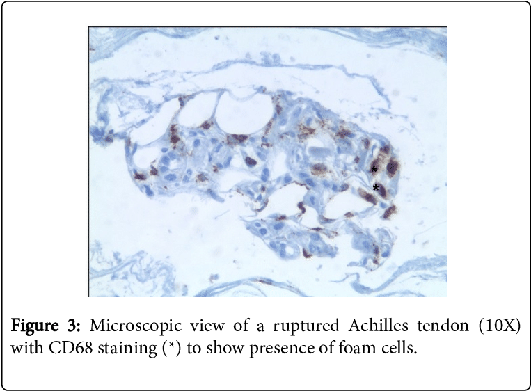 Shows The Results Of The Laboratory Tests - Snow (769x569), Png Download