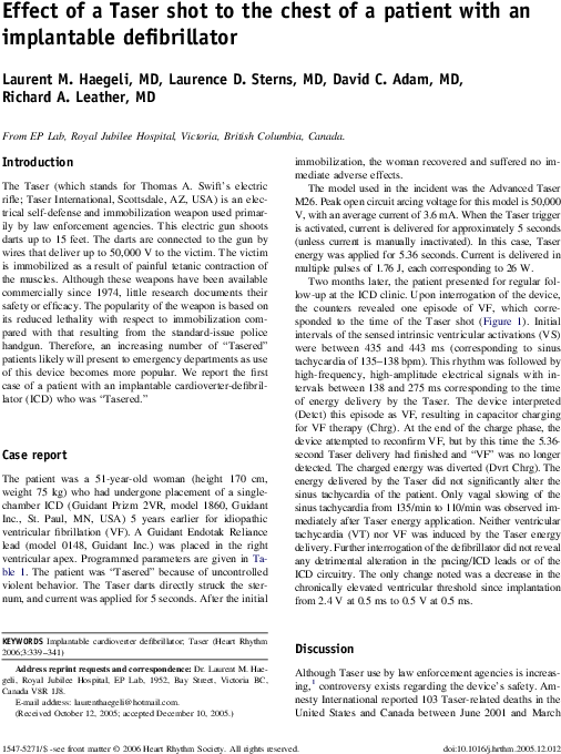 Pdf - Untitled, Illustration 14, In The Book Foirades / Fizzles (576x774), Png Download
