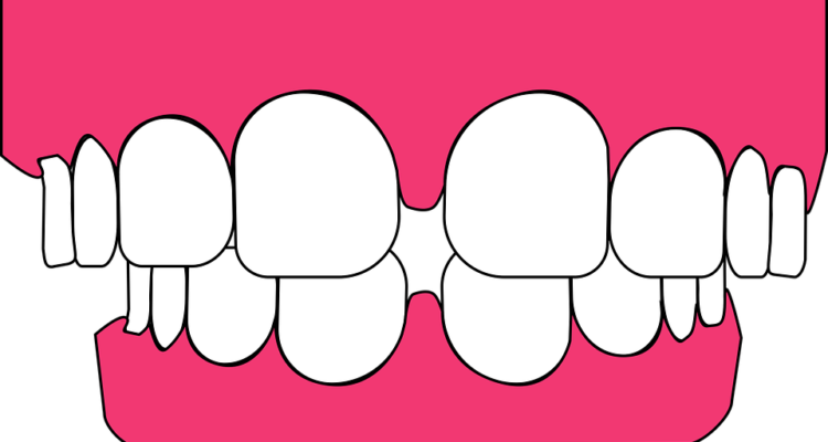 Clip Art Black And White Jasper Ave Dental Tips To - Teeth Graphic (750x400), Png Download