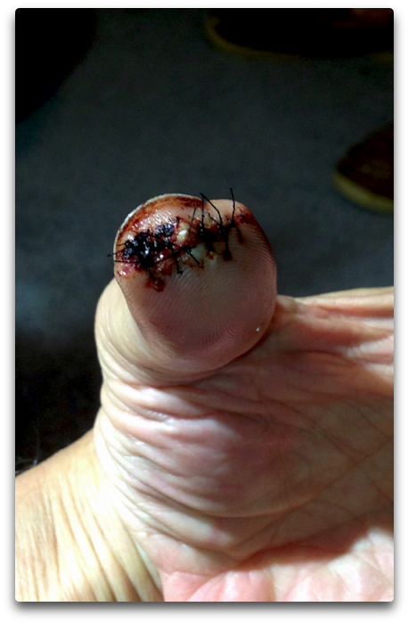 Bad Thumb - Insect (502x755), Png Download