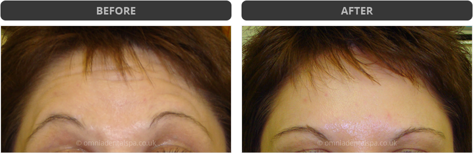 Raising Eyebrows - Eye Shadow (980x345), Png Download