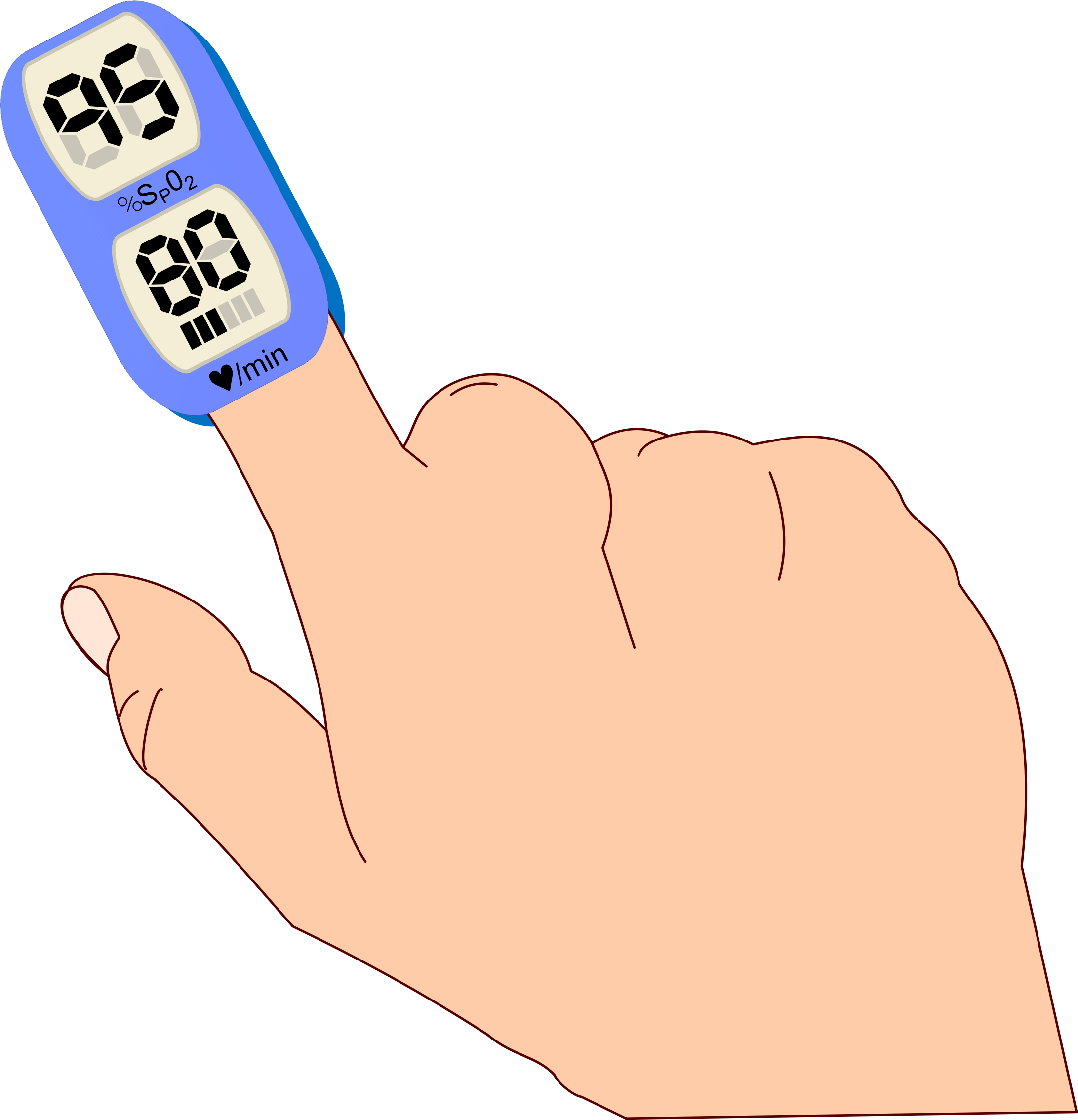 Thumb Pulse Oximetry Pulse Oximeters Oxygen Saturation - Pulse Oximeter Clipart (722x750), Png Download