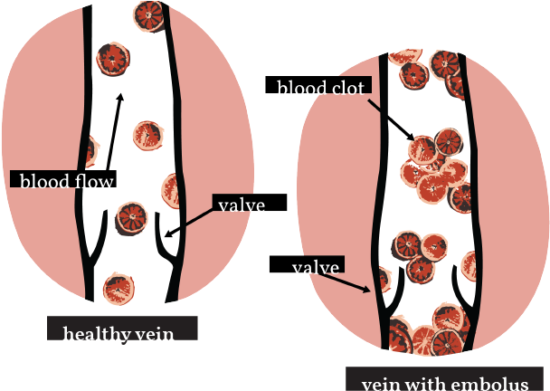 Dvt Web Full - Circle (702x491), Png Download