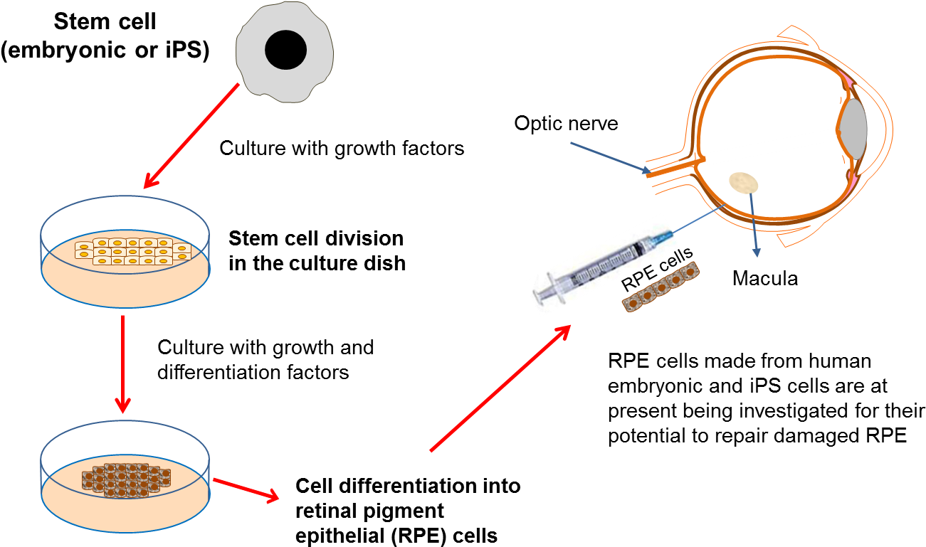 Diagram On Developing Eye Therapies - Stem Cell Eye Therapy (1347x790), Png Download