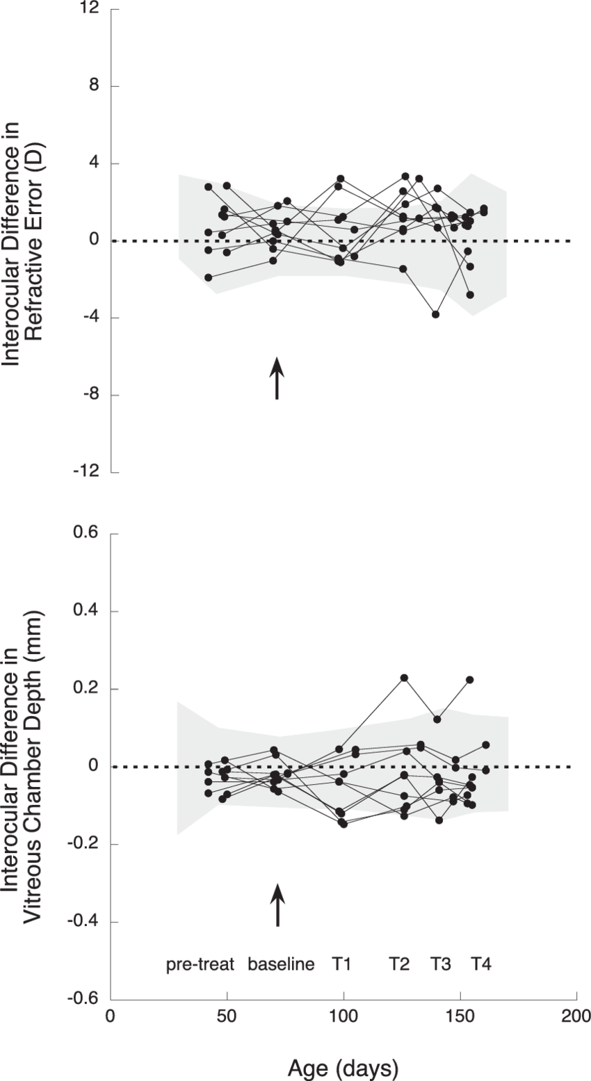 Interocular Differences At Pretreatment - Diagram (850x1555), Png Download