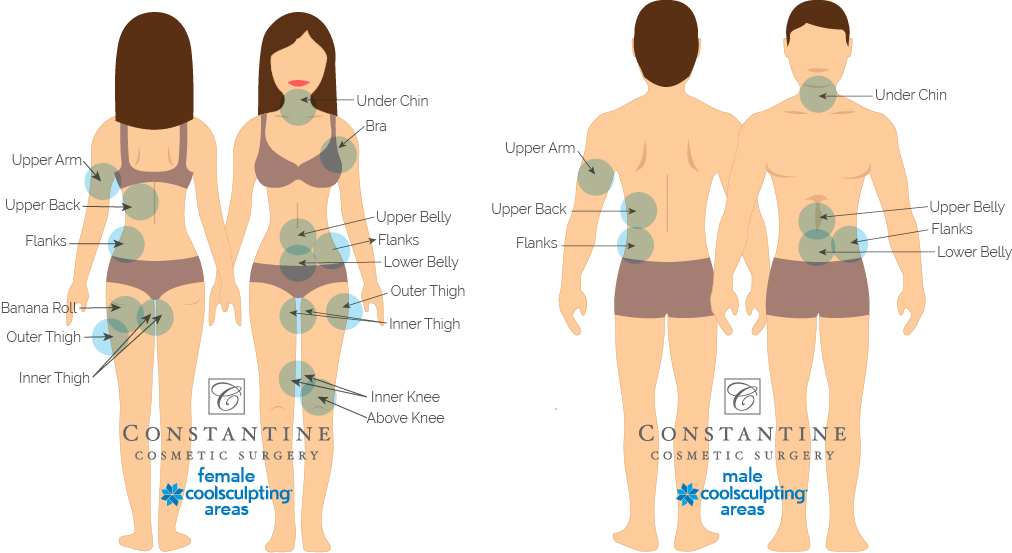 No Matter Which Area You May Be Considering For Coolsculpting, - Cartoon (1012x553), Png Download