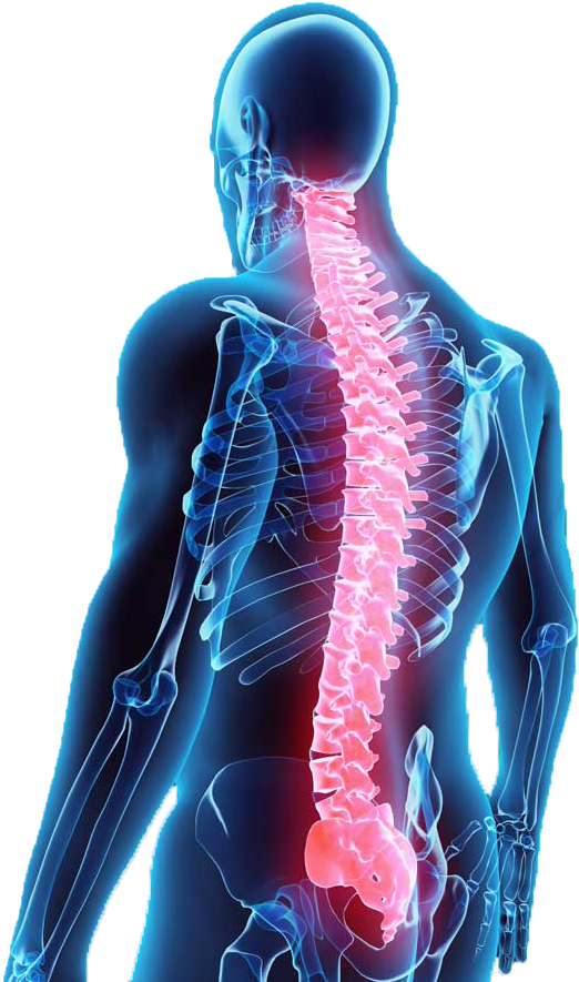 Illustration Of Back With Spine Shown In Red - Spine Surgery Cost Banner (741x900), Png Download