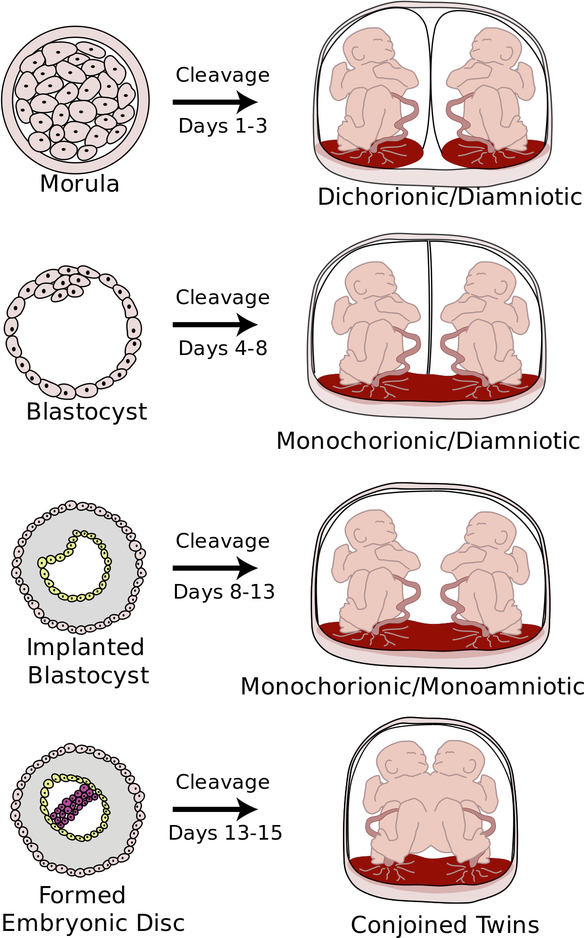 Monochorionic Twins (300x479), Png Download