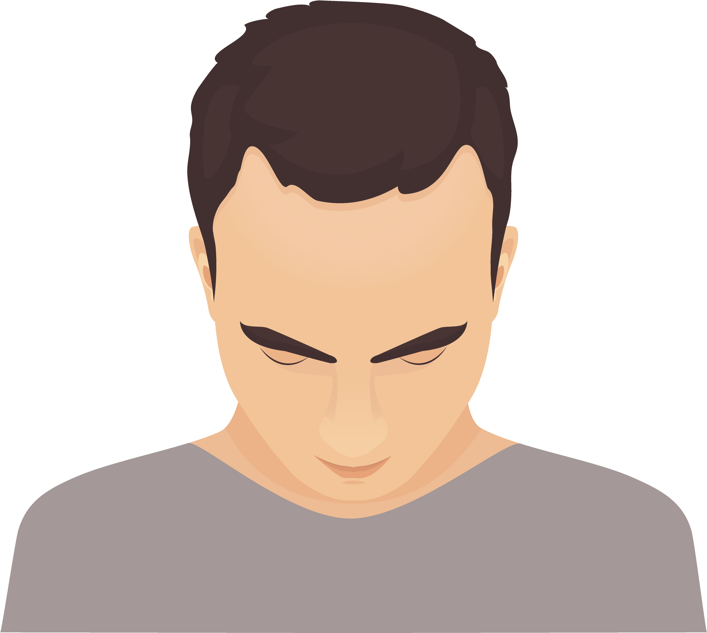 Phase 1 Of Baldness Is Recognized By The Presence Of (3380x3330), Png Download