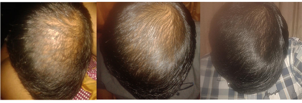 Dermatologist In Chennai (1000x375), Png Download