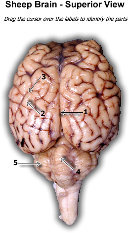 Superior View Of Sheep Brain - Sheep Brain Superior View (600x575), Png Download