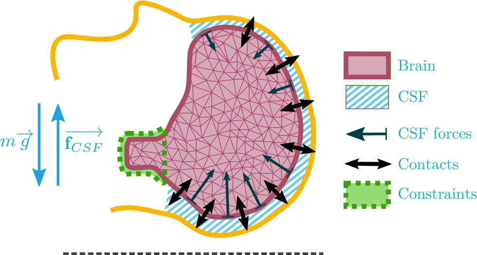 Patient-specific Biomechanical Simulation For Deep - Diagram (1000x523), Png Download