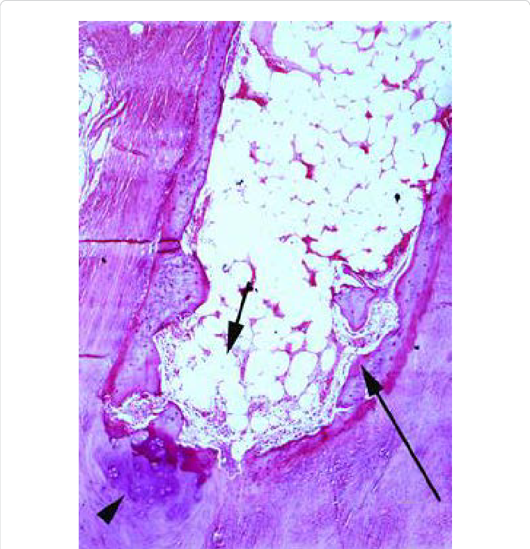 Higher Magnification Of Figure 1 Showing The Spongy - Creative Arts (761x787), Png Download