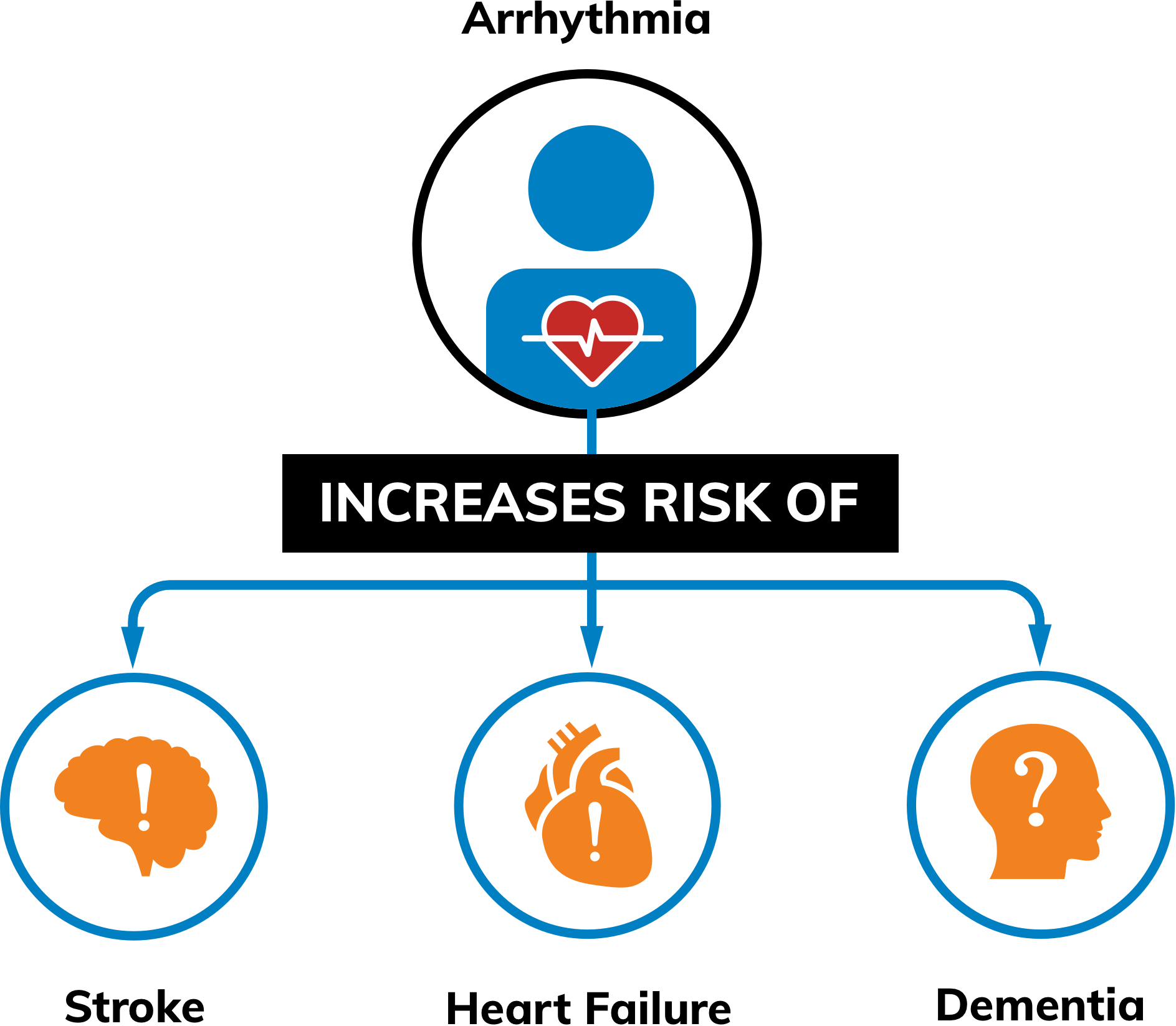 Irregular Heart Rhythms Increase Your Risk Of Stroke - Diagram (1887x1647), Png Download