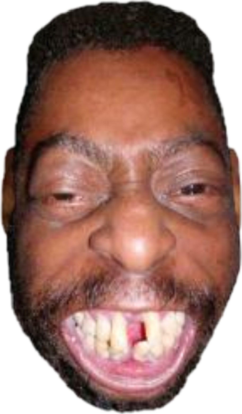 Beetlejuice Sticker - Black People With Fucked Up Teeth (1024x1749), Png Download