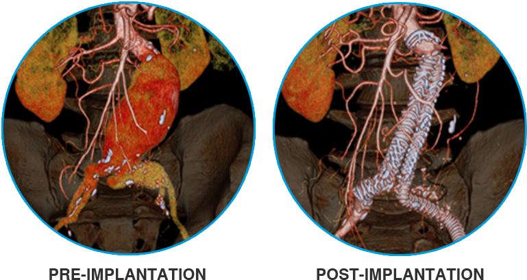 3d Reconstruction Images Courtesy Of Dr - Freshwater Crab (800x500), Png Download