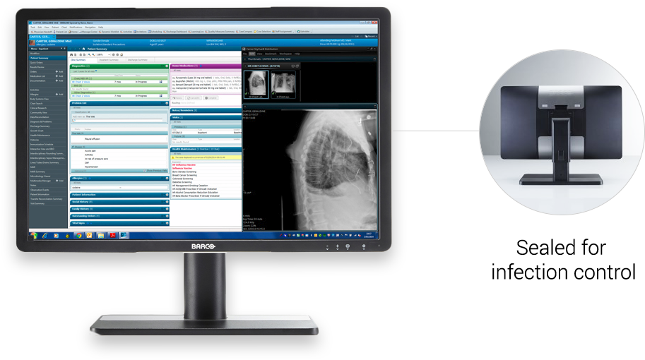 Book A Demo - Barco Mdrc 2224 Bl (1170x543), Png Download