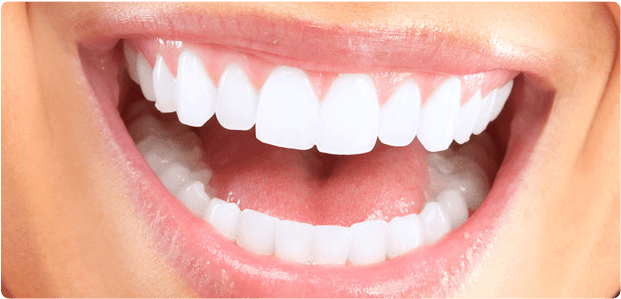 White Teeth - Does Straight Teeth Look Like (970x320), Png Download