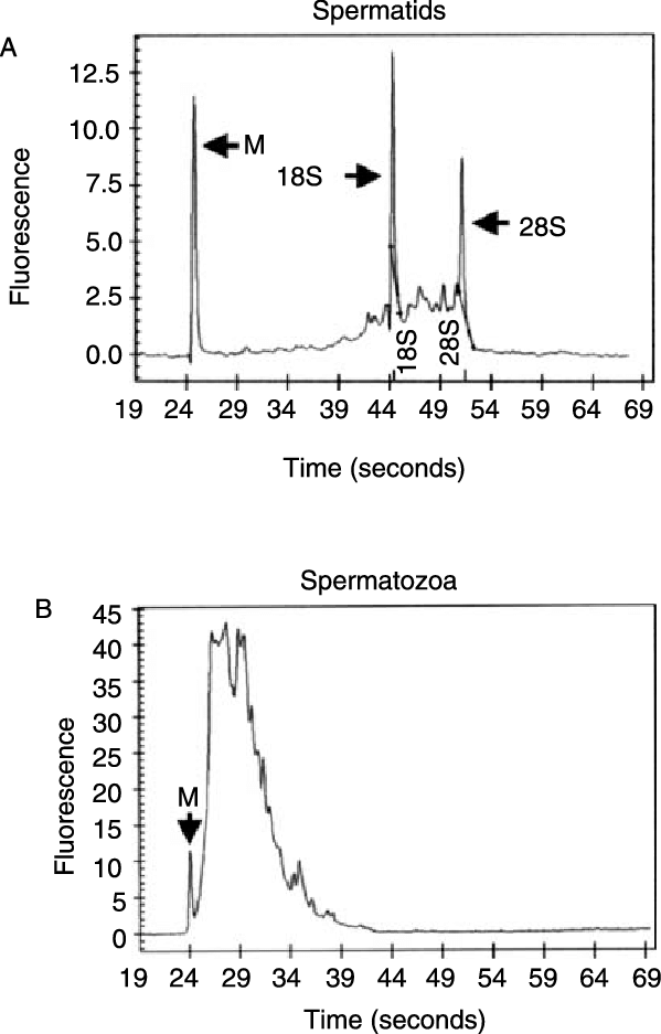 Total Rna Microelectrophoretic Profiles Of Spermatids - Diagram (599x937), Png Download