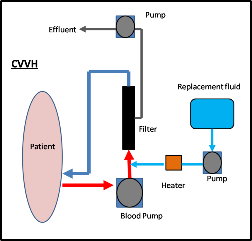 Acute Kidney Injury Requiring Renal Replacement Therapy, - Diagram (860x822), Png Download