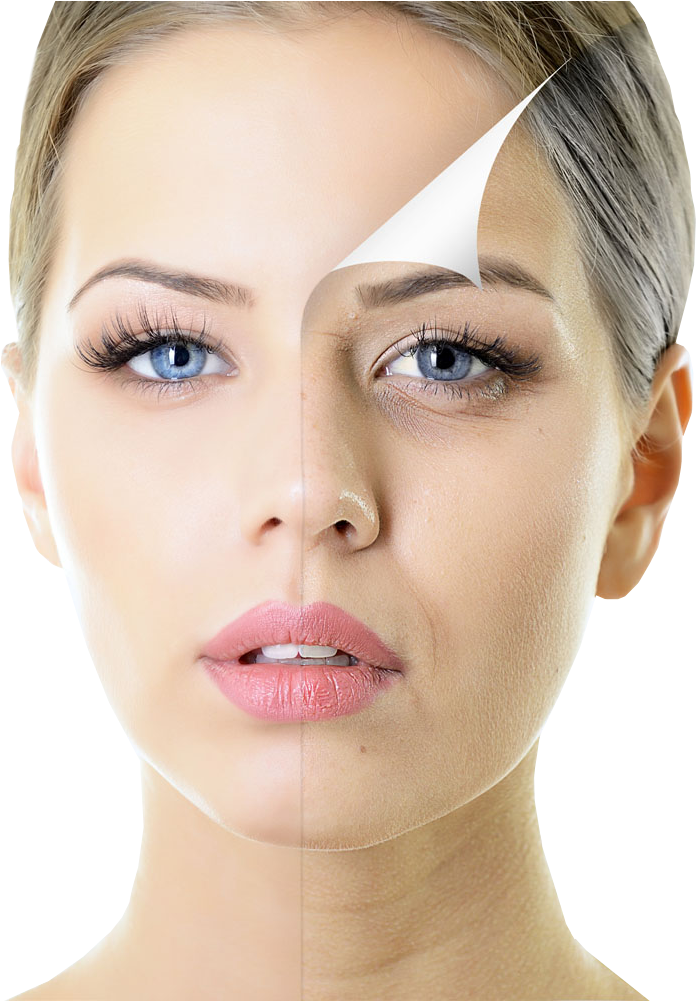 Beautiful Woman With Half Face Spotty Skin (809x1000), Png Download