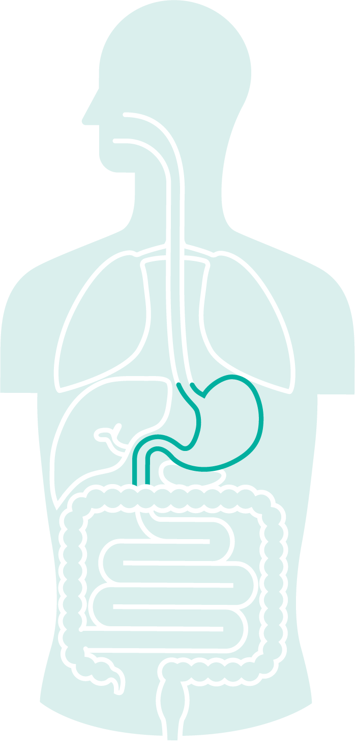 Gi Cancer - Stomach (700x1464), Png Download