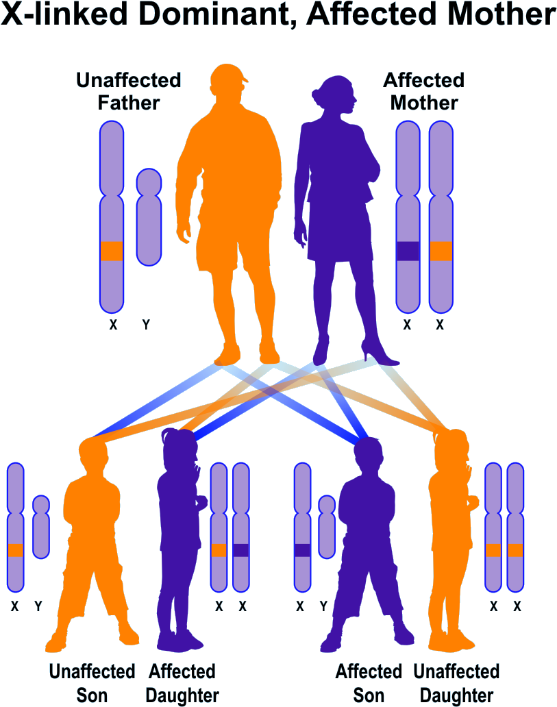 X-linked Dominant, Mother Affected - X Linked Dominant (993x1122), Png Download