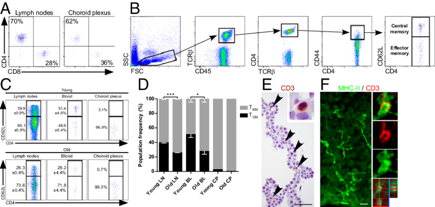 The Choroid Plexus Is Populated By Effector Memory - Cd4 Choroid Plexus (850x404), Png Download