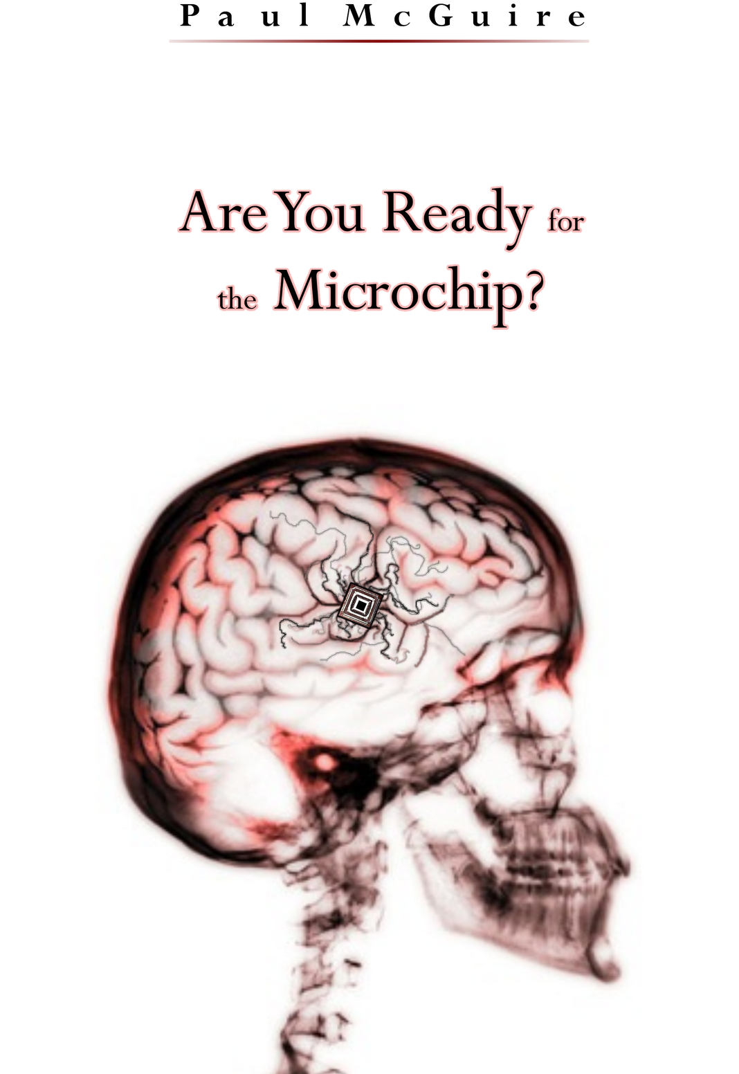 The Microchip Implant & The National Biometric Id Card - Radiology Invitation Cards (1067x1600), Png Download