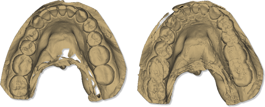 File - Maestro - 3d - Easy - Dental - Scan - Calibration - Scanner 3d Dentale (1029x419), Png Download