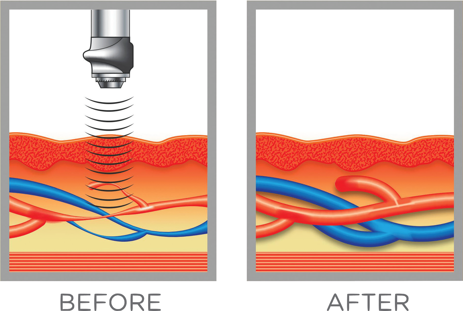 Swiss Wave Therapy Demo11 - Stl Medical Solutions St. Louis' Premier Men's Clinic (2136x1355), Png Download