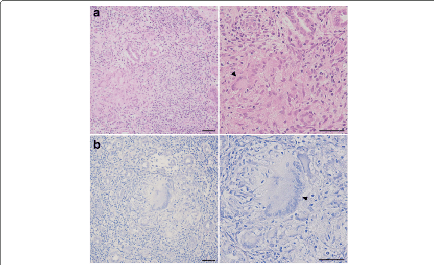 A Hematoxylin And Eosin Staining - Tile (850x519), Png Download