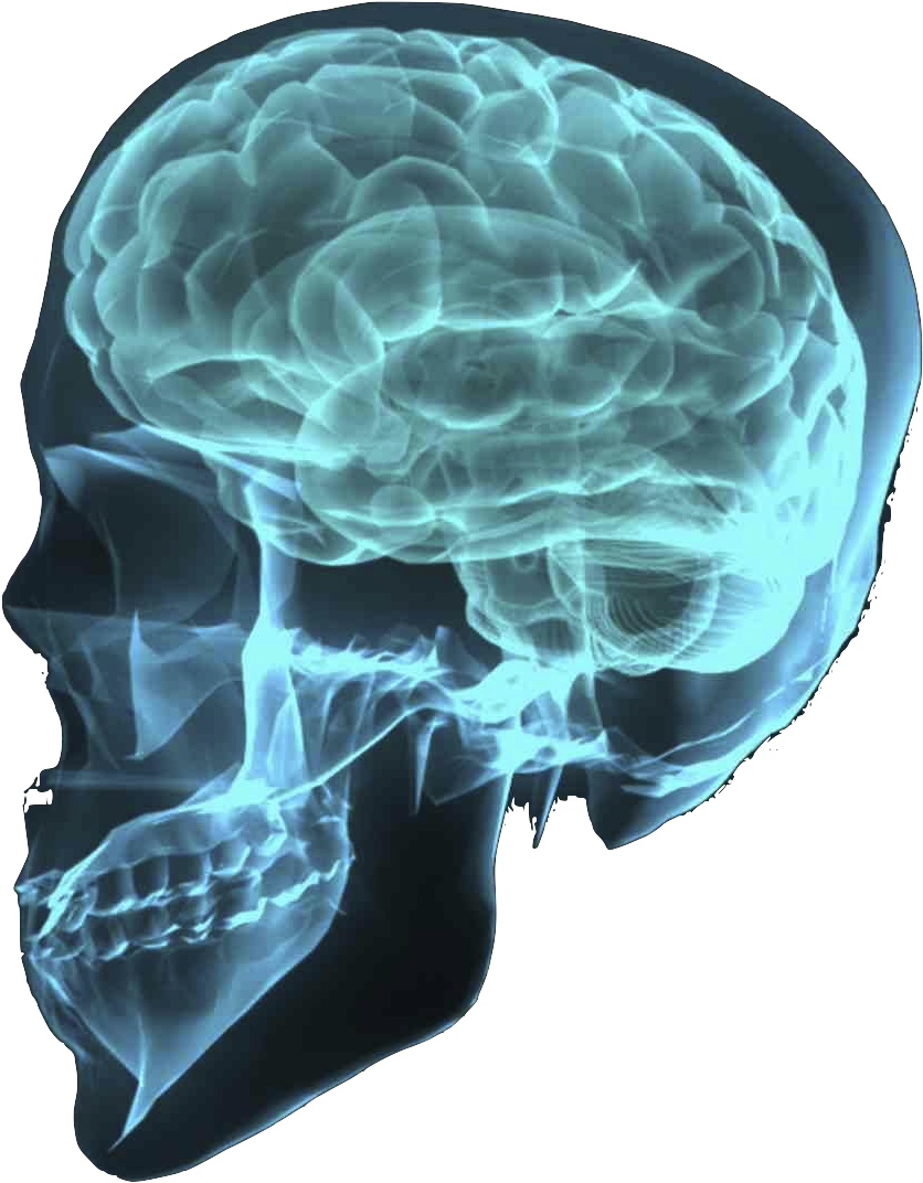 X-ray Png Transparent Image - Brain X Ray Transparent (943x1149), Png Download