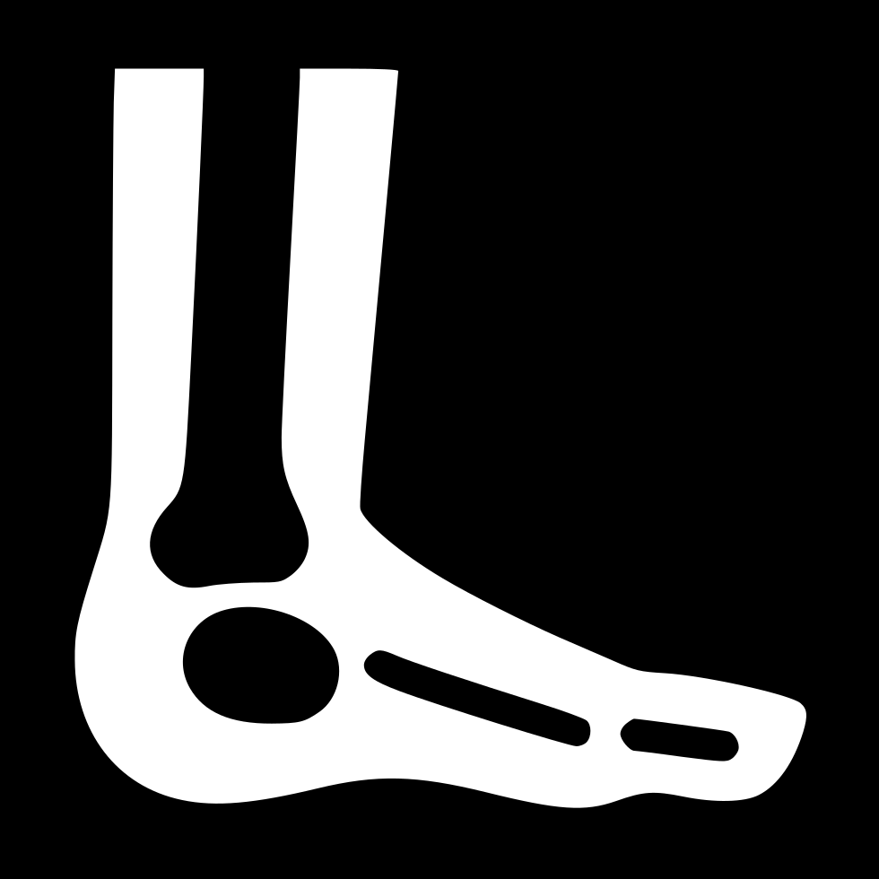 Foot X Ray Comments - Foot (980x980), Png Download