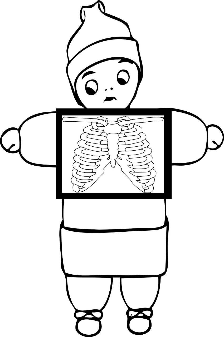 X Ray Happy Clip Art At Clker - Outline Image Of X Ray (396x597), Png Download