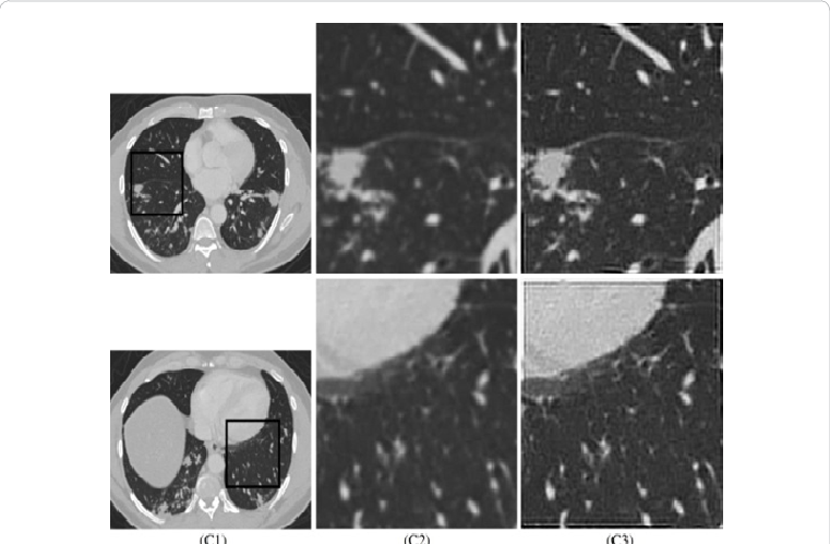 Processing Naturally Blurred Ct Images - Monochrome (761x499), Png Download