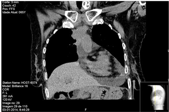 (b) (c) - Radiology (903x388), Png Download