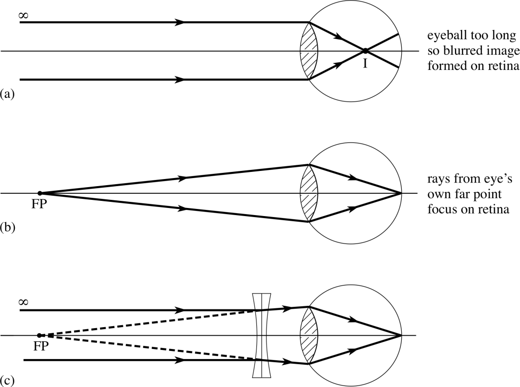 Diagrams Cbse Class Class X Physics Light Reflection - Short Sighted Ray Diagram (1024x763), Png Download