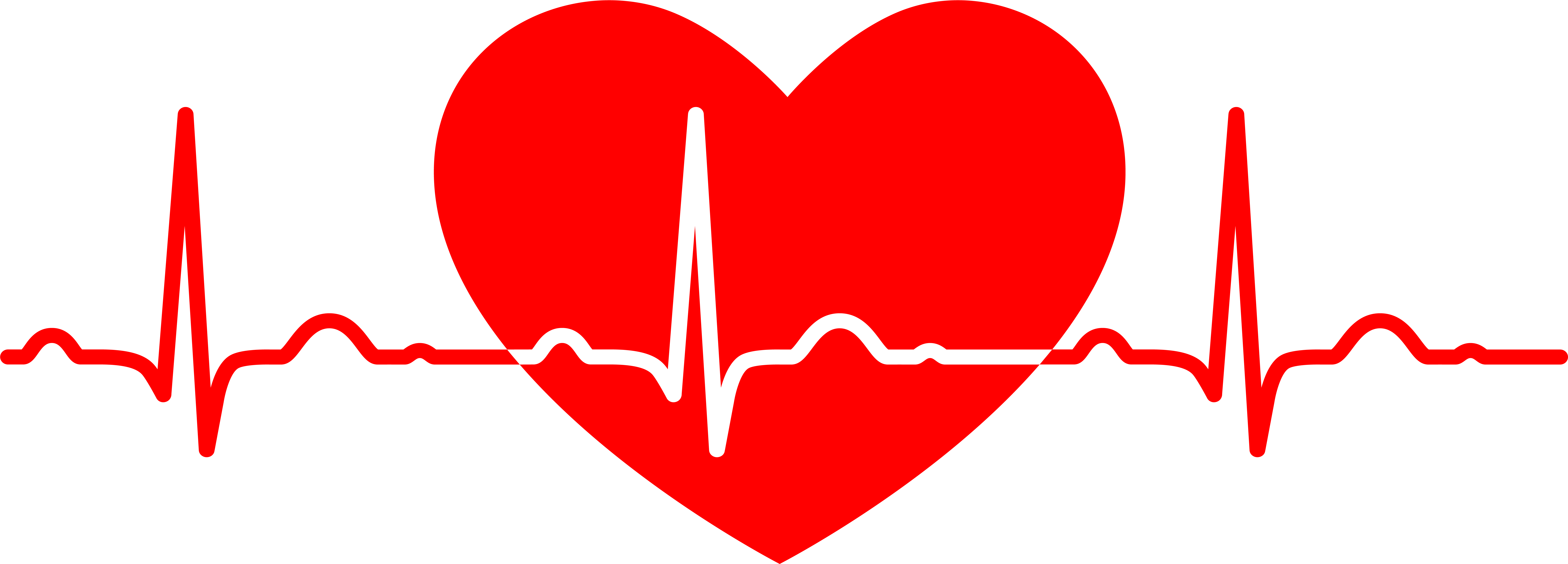 Electrocardiography Heart Rate Medicine Clip Art (9329x7050), Png Download
