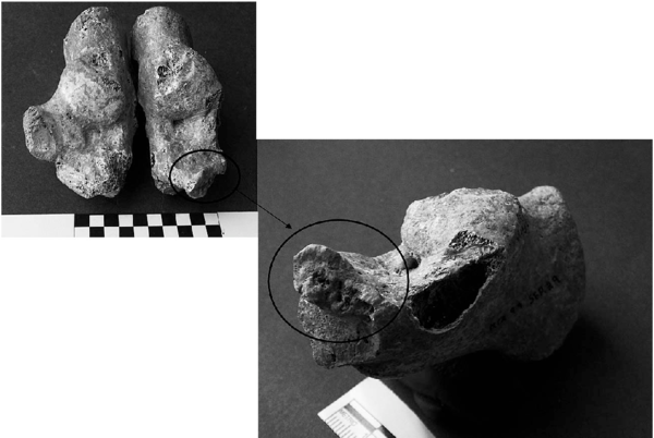 Left And Right Calcanei Of The Adult Female Skeleton - Monochrome (850x401), Png Download