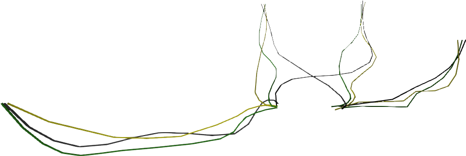 Bomb Wires - Wires Png (992x387), Png Download